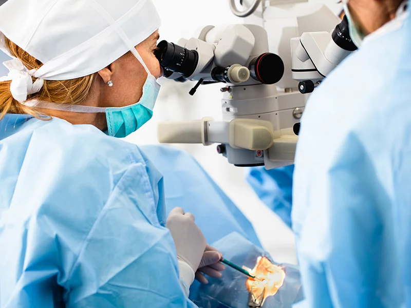 Cataract surgery